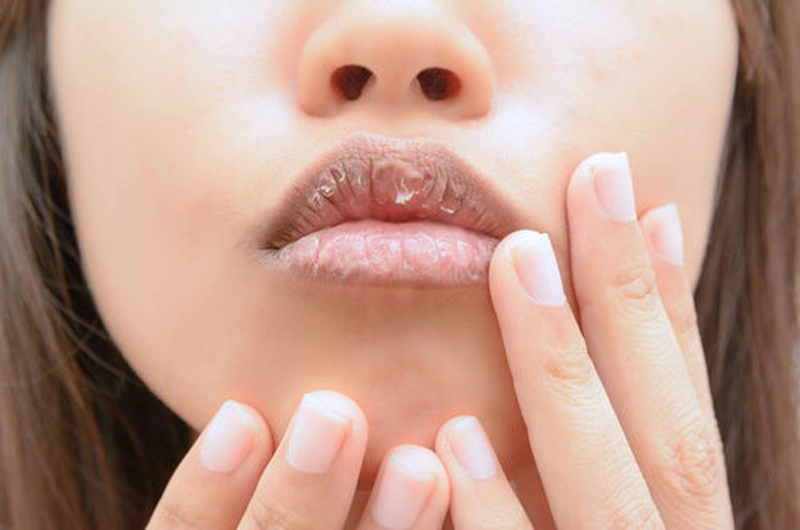 Algunos consejos para tí... Labios con grietas por el frío