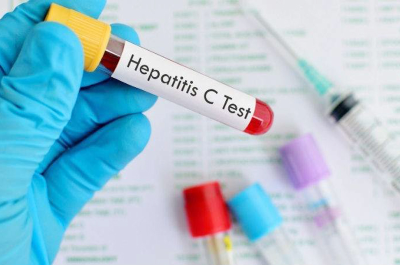 Insta el Distrito de Salud a hacerse examen para detectar la hepatitis
