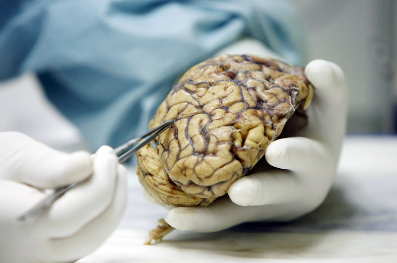 Científicos de Cuba y México desarrollan investigaciones para tratar el Alzheimer