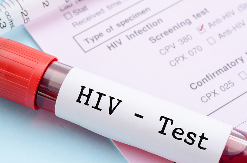 AIDS Healthcare Foundation ofrece exámenes gratis para detectar ETS