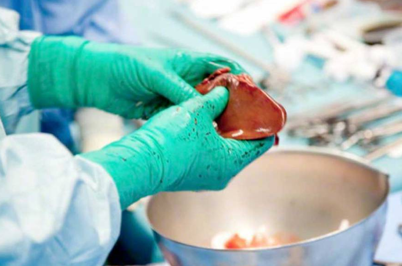 IMSS Guerrero aumenta donaciones de órganos en 2017